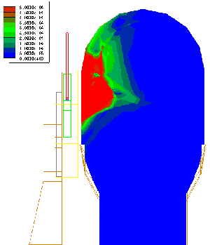 rf power absorbed in the head - front view