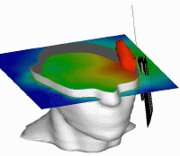 rf power absorbed in the head - dimensional view